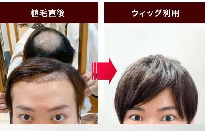 プライバシーに配慮した治療環境